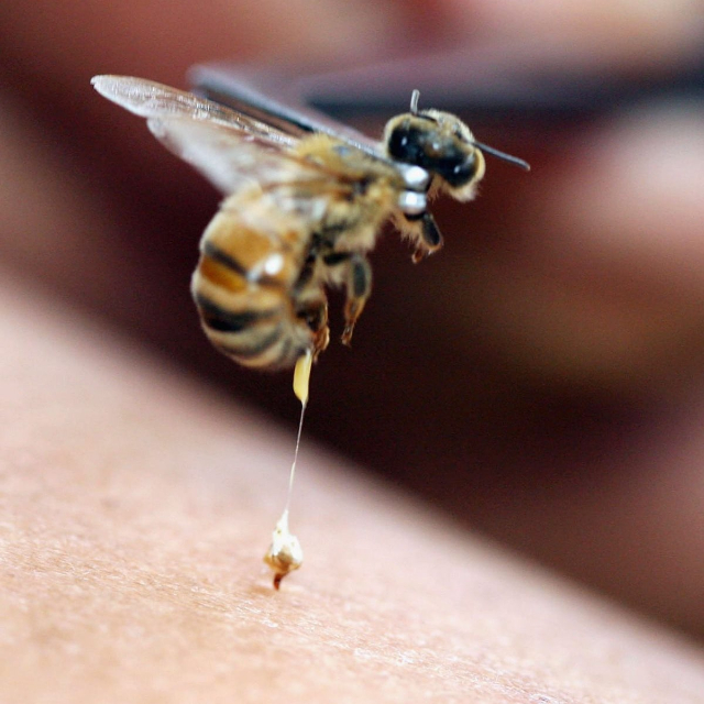 Bị ong vàng đốt có nguy hiểm không và cách phòng tránh 
