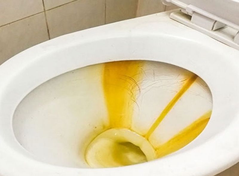 Cặn vôi trong bồn cầu là gì và vì sao cần xử lý?