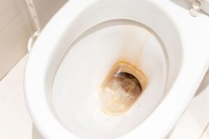 Cách tẩy cặn vôi trong bồn cầu sạch bong, dễ thực hiện tại nhà